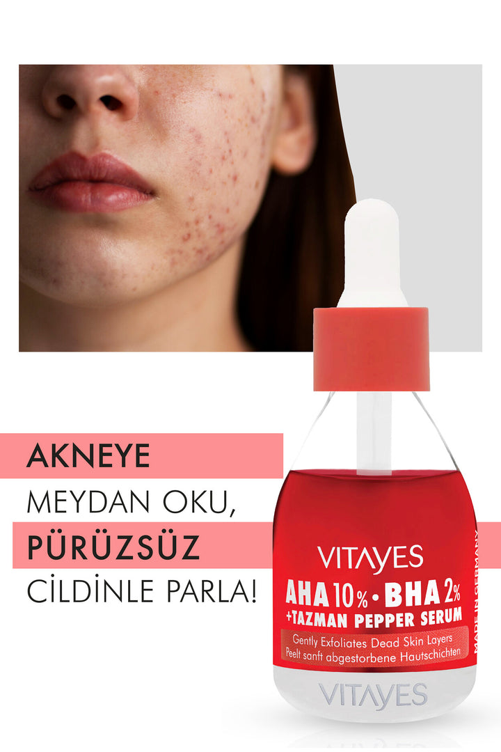 Sivilce Akne Lekeleri Karşıtı Gözenek Sıkılaştırıcı Yenileme Etkili Vitayes Aha & Bha Peeling Serum
