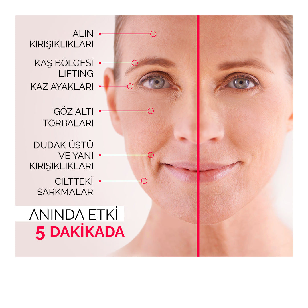 Kırışıklık & İnce Çizgiler Göz Altı Morluk ve Sıkılaştırıcı Anında Anlık Etkili Vitayes Germe Yüz Kremi