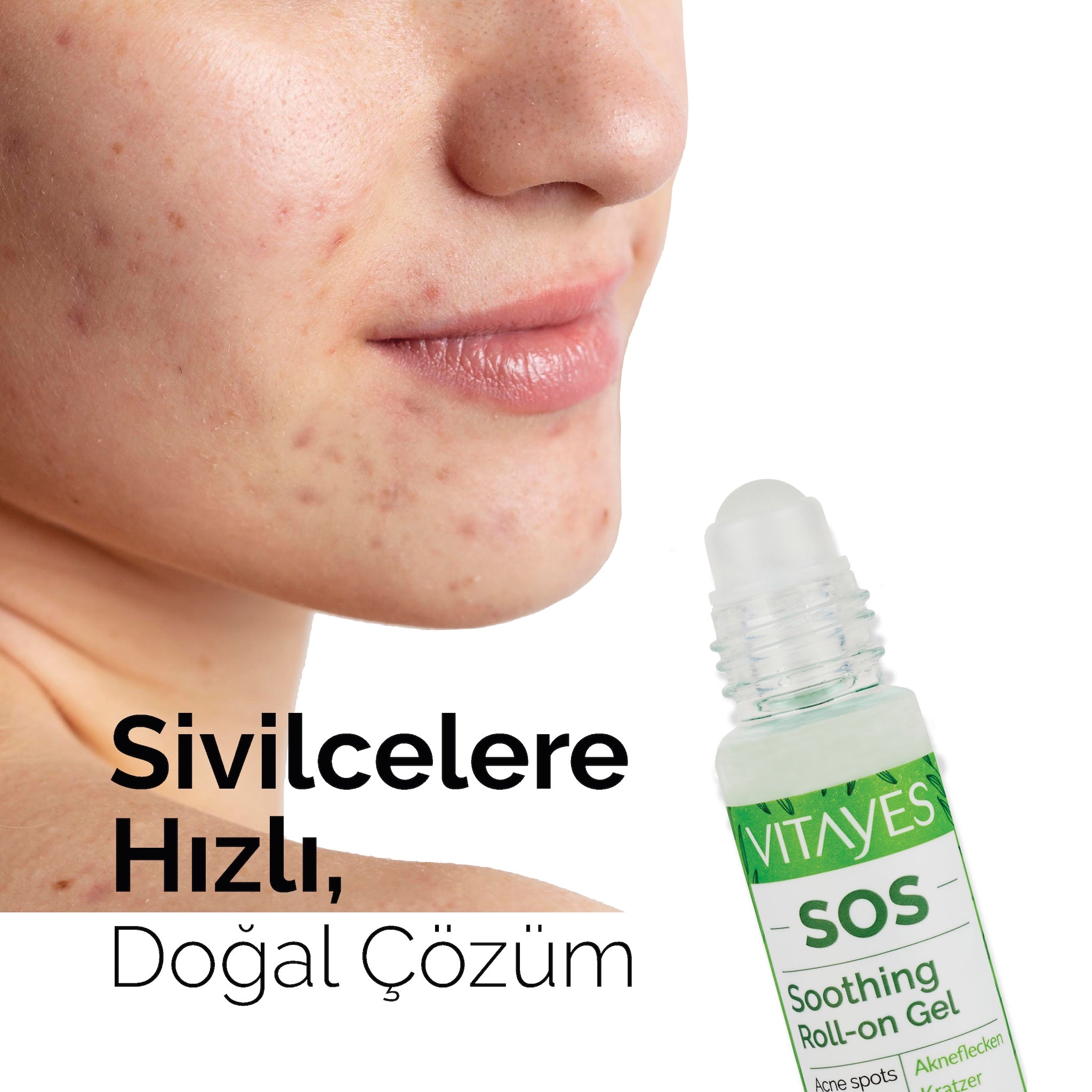 SOS Onarıcı Serum Doğal Çay Ağacı Özlü Serum - Vitayes